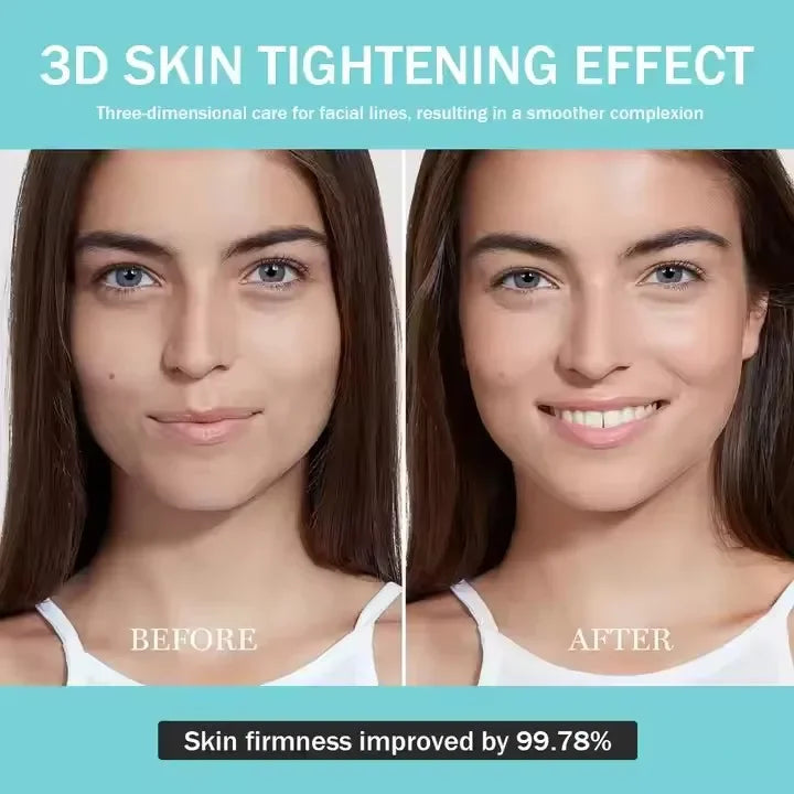 Age-R Booster H Skin Care. Rejuvenecimiento Facial con Efecto Adelgazante/Modelador/ Masajeador/Blanqueador/Hidratación/ Tensión/Firmeza para Rostro y Cuello